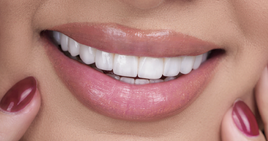 Close-up of a patient's bright smile showing evenly shaped teeth and natural-looking cosmetic dental aesthetics