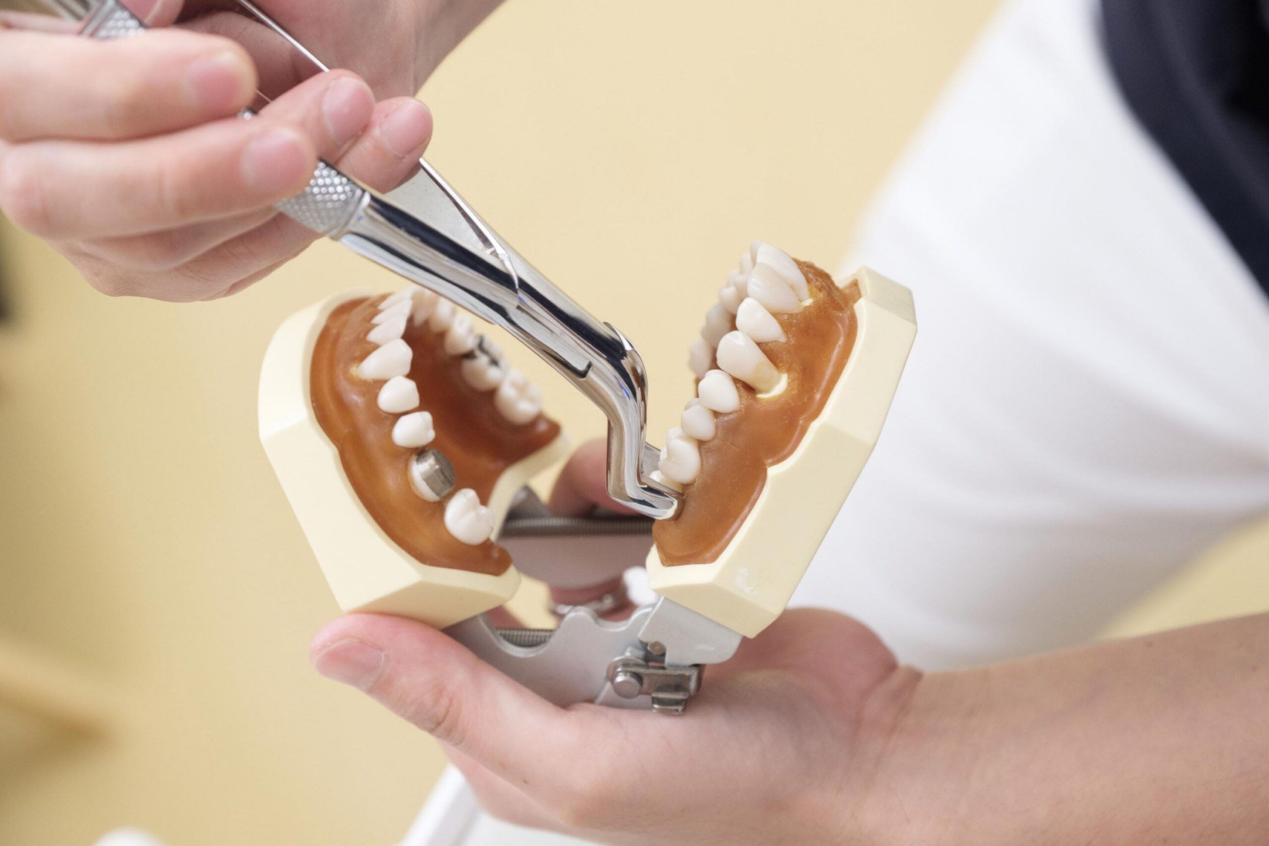 Dental professional demonstrating a dental procedure using an anatomical model of teeth and gums