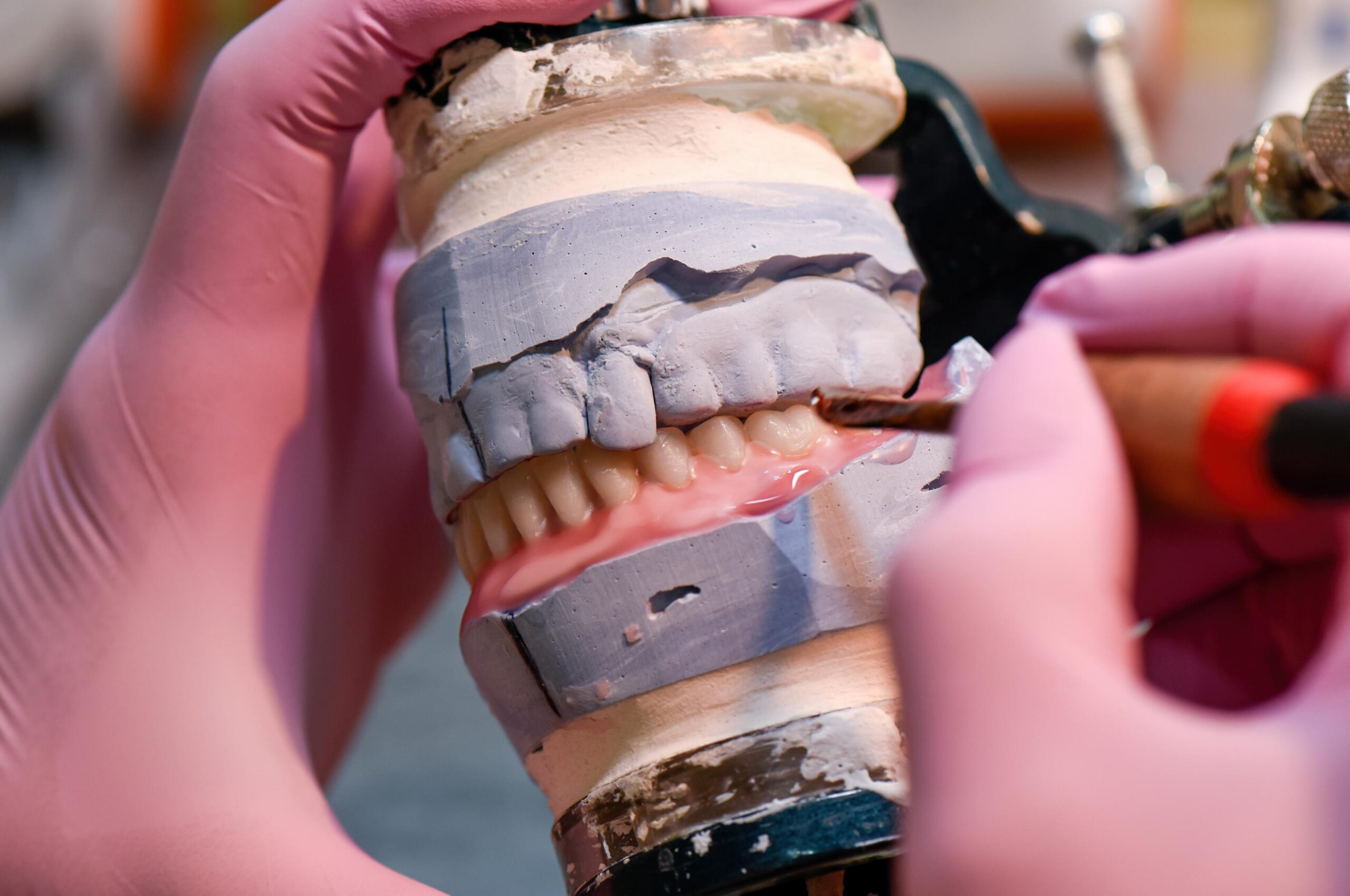 Close-up of dental prosthetics and tools used during the fabrication of custom dental restorations