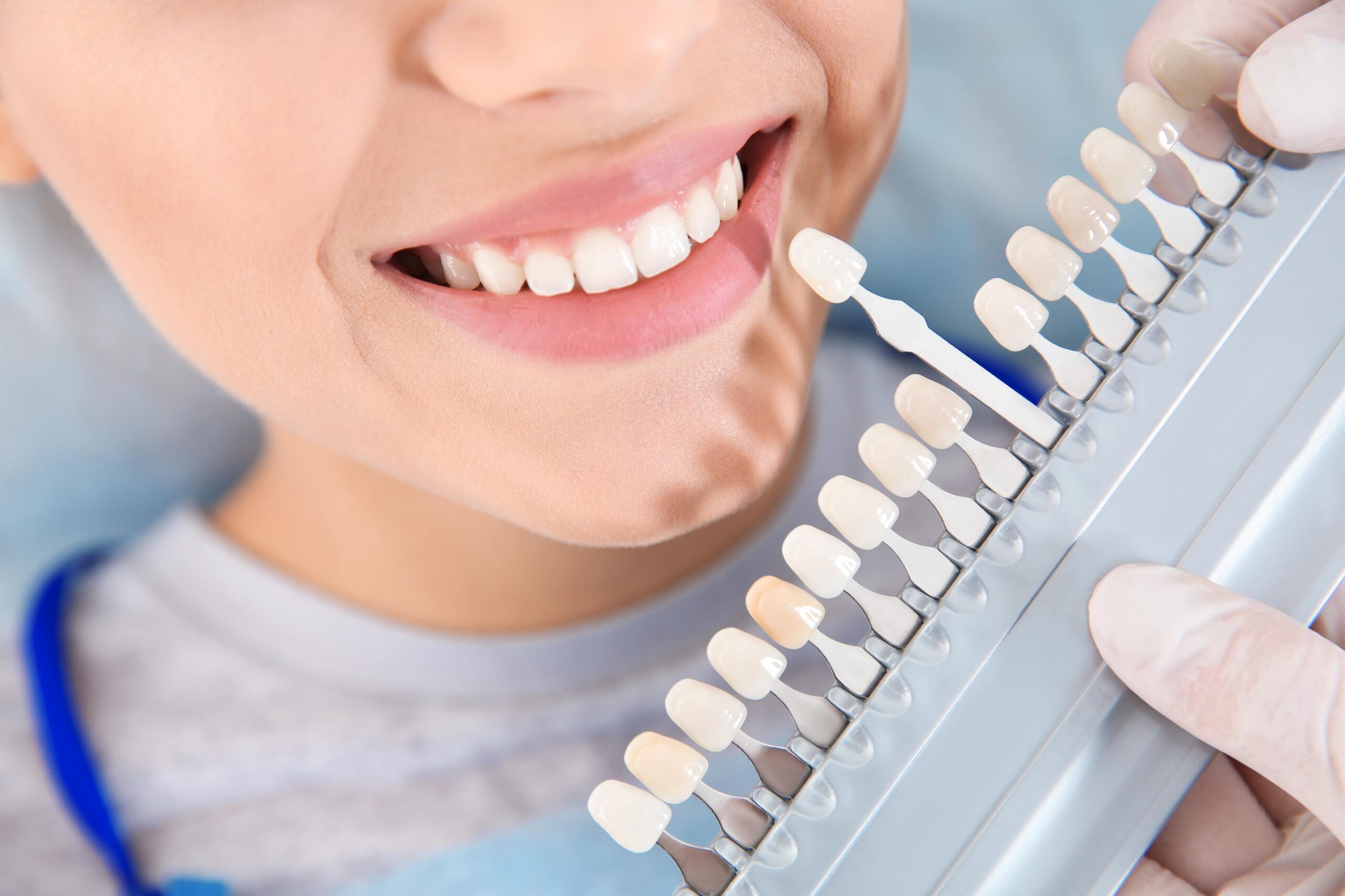 Dentist comparing tooth shades using a dental shade guide to select a natural-looking restoration color