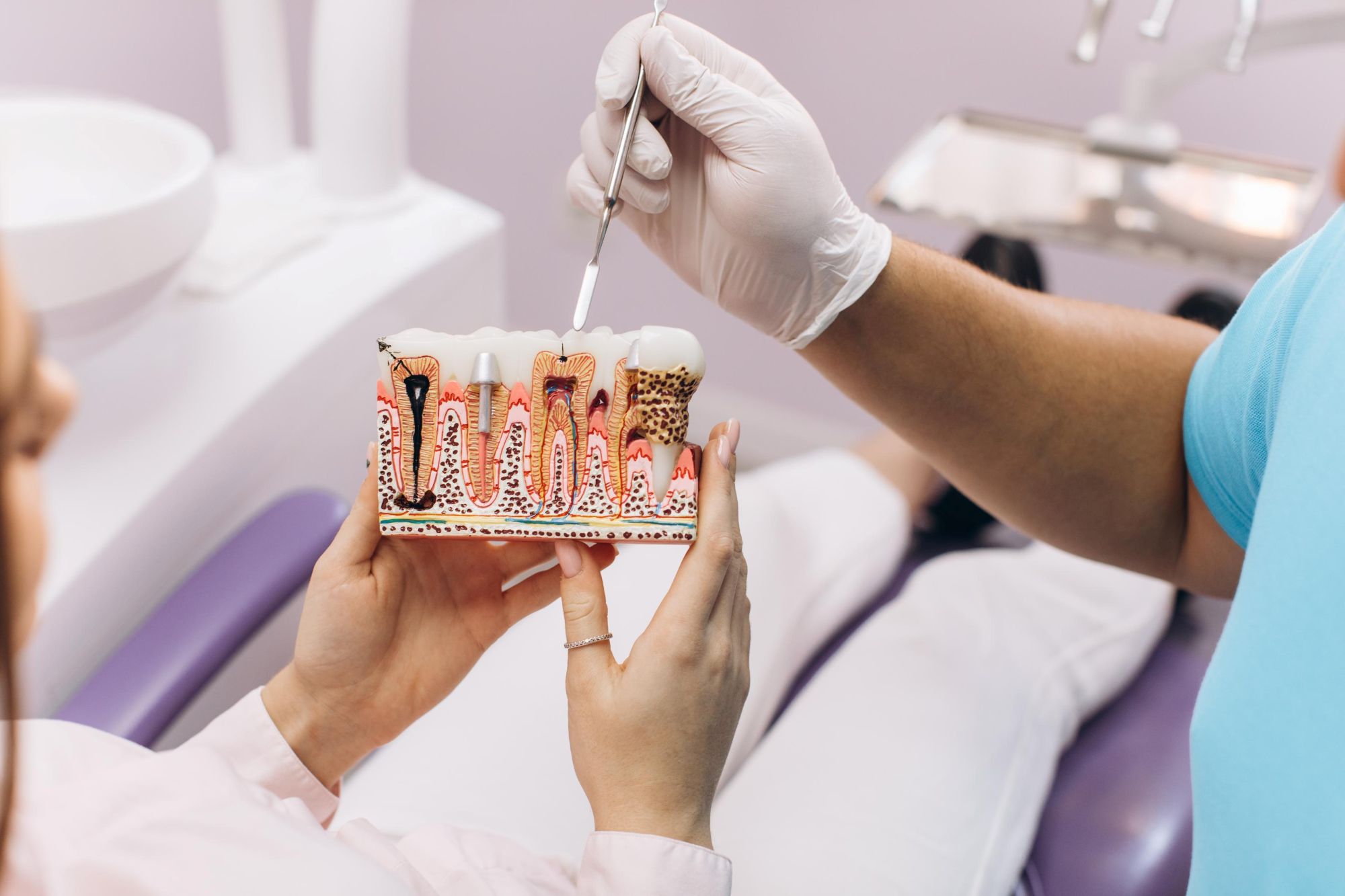 Dental model showing tooth root canals and instruments used to illustrate endodontic root canal therapy