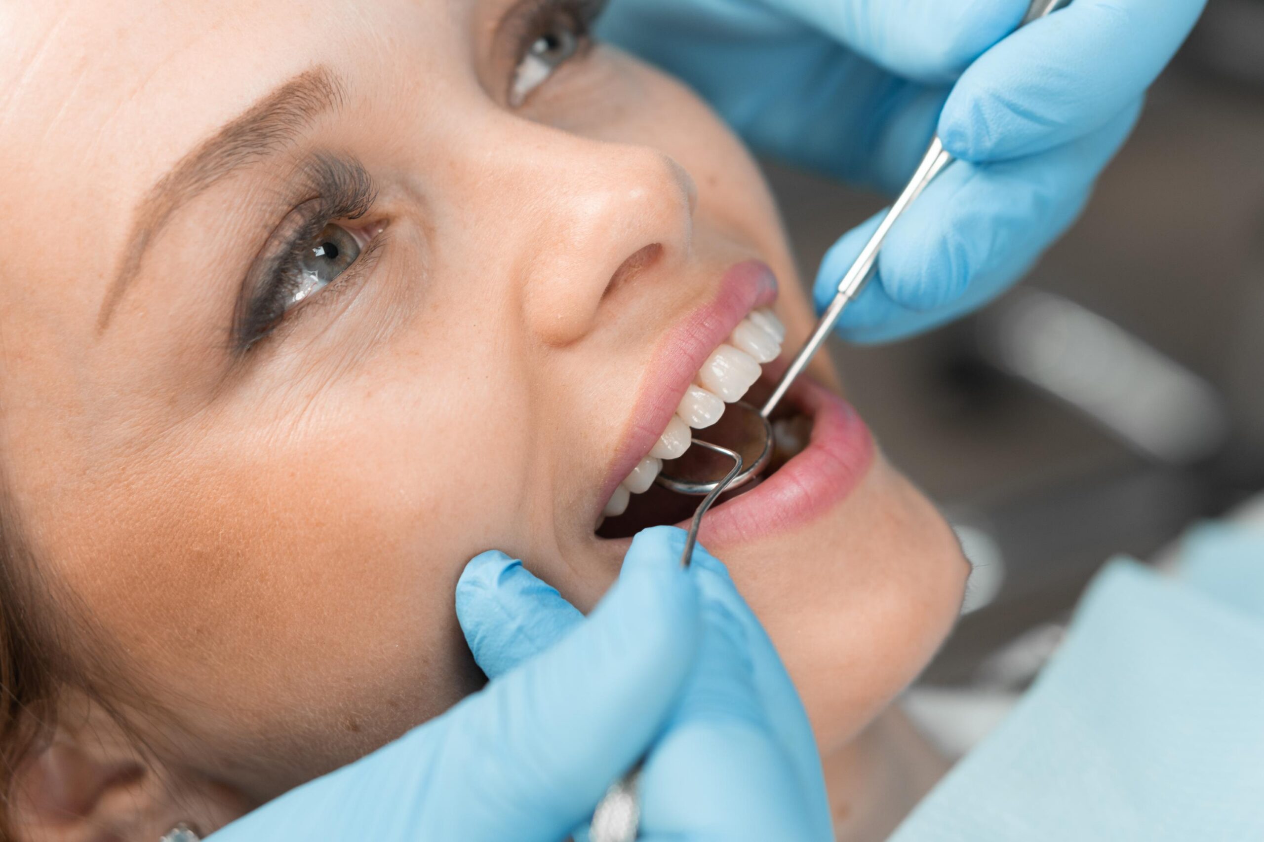 Patient receiving a dental checkup while a dental professional uses a mirror to examine her teeth
