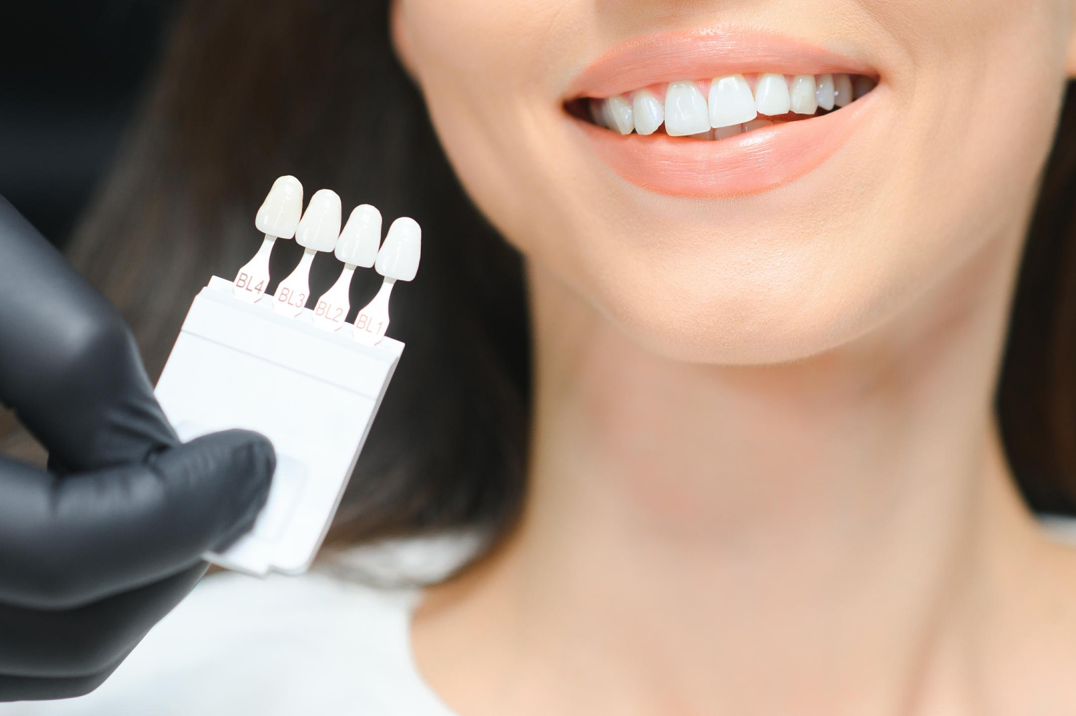 Woman comparing a dental shade guide with her natural teeth to evaluate tooth color for cosmetic dentistry